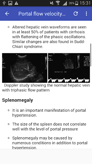 Portal hypertension Screenshot 3