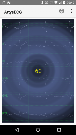AttysECG Screenshot 3