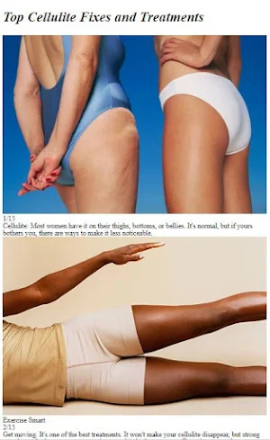 How to Get Rid of Cellulite Screenshot 2