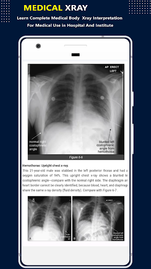 X-Ray Interpretation Guide Screenshot 1