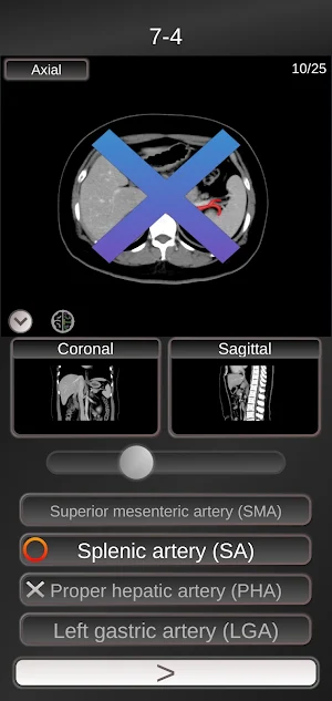 CT PassQuiz Abdomen / sectional anatomy / MRI Screenshot 1