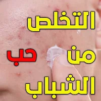 علاج حب الشباب بدون انترنت