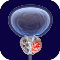 prostate treatment