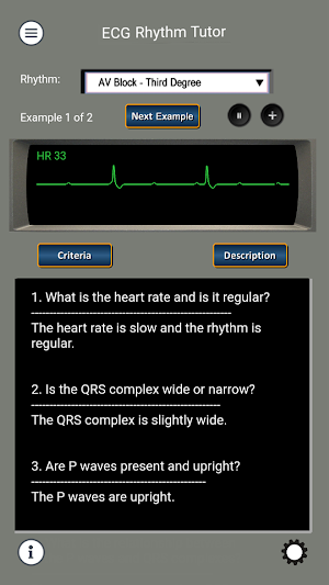 ECG and ACLS Tutor Screenshot 2
