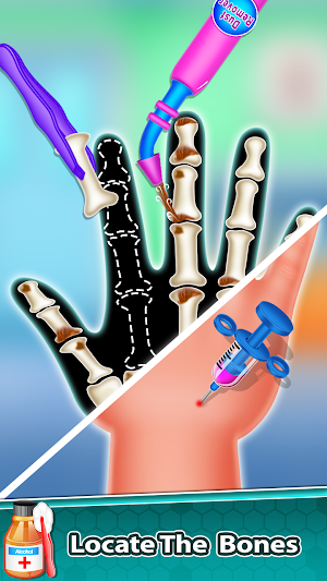 Nail & Hand Surgeon Hospital - Nail Surgery Game Screenshot 3
