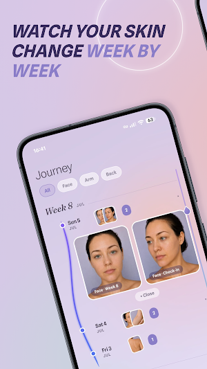 Glaze: Skin & Acne Tracker Screenshot 0