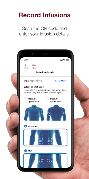Hizentra App Screenshot 1