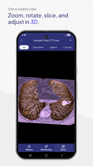 3DICOM Mobile Screenshot 1