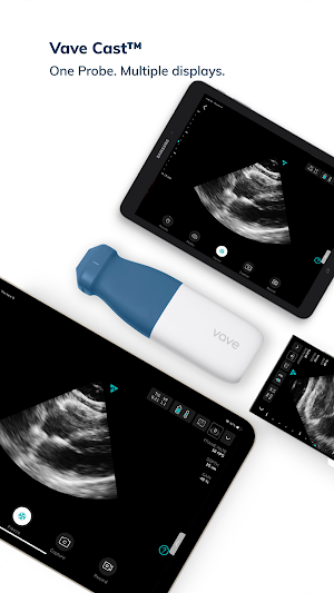 Vave Wireless Ultrasound Screenshot 1