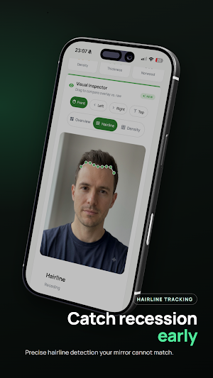 Trichometrics: Hair Loss AI Screenshot 1