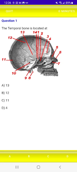 Test Exam Osteology Review Screenshot 3