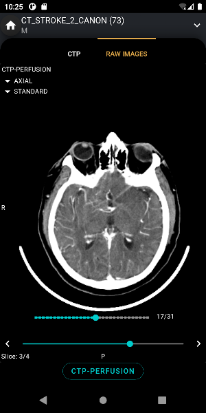 S.I.A Neurovascular Care Screenshot 1