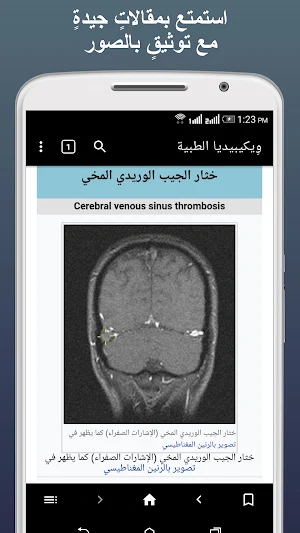 ويكيبيديا الطبية بلا إنترنت Screenshot 2