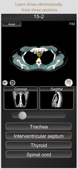 CT PassQuiz Chest / sectional anatomy / MRI Screenshot 2