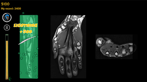 Anatomy Ninja Upper Limb Screenshot 2