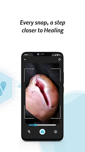 WoundTele: AI Wound Care Screenshot 1