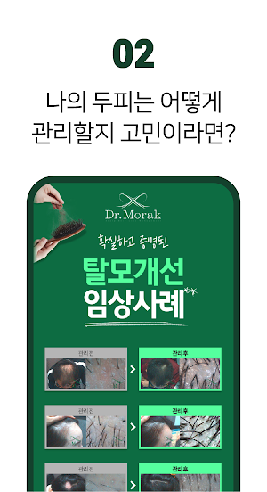 탈모 두피 케어 어플 - 탈모 두피 관리 정밀진단 체험 Screenshot 2