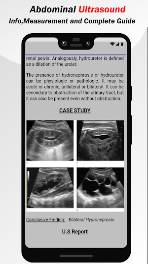 Abdominal Ultrasound Guide Screenshot 2