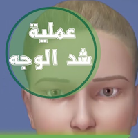 عملية شد الوجه