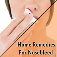 Home Remedies For Nosebleed