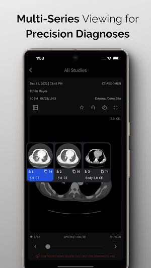 NeuroView Screenshot 3