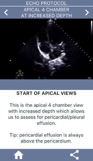 LEARN THE FULL TTE ECHO ULTRASOUND PROTOCOL DEMO Screenshot 2