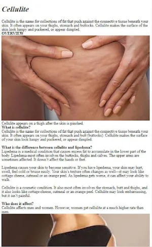 How to Get Rid of Cellulite Screenshot 0