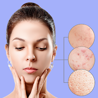 Pimple Remover - Beauty Face