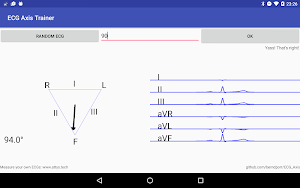 ECG Axis Trainer Screenshot 1