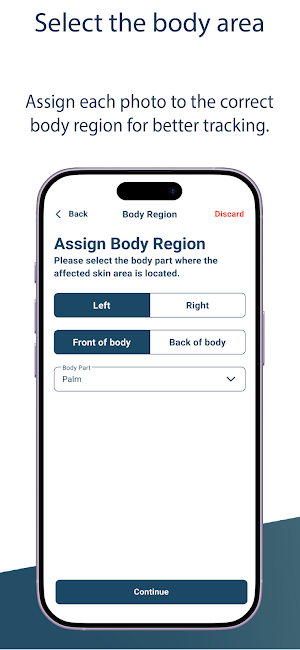 SkinAware Screenshot 2