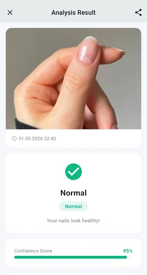 NailCheck AI Screenshot 2