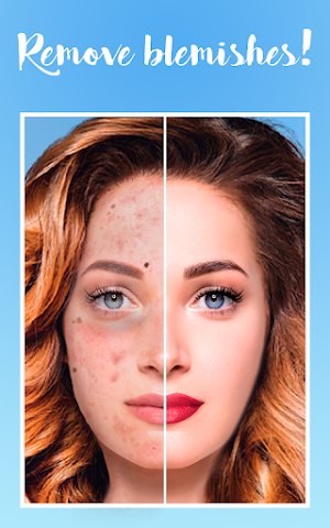 Blemishes Removal: beauty face camera Screenshot 0