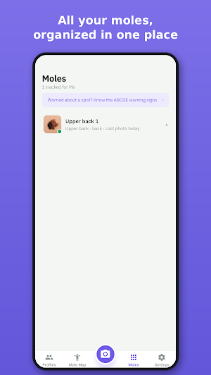 Holey Mole - Scan and Track Screenshot 3