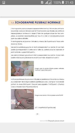 Guide d’Échographie Screenshot 0