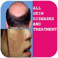 Skin diseases and treatment offline