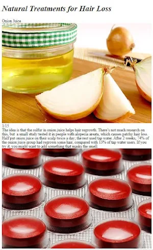Hair Loss Home Remedies Tips Screenshot 3