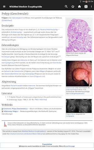 WikiMed - Wikipedia Medizin (Offline) Screenshot 2