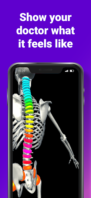 Chronic Insights: 3D symptom diary Screenshot 2