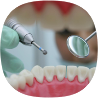 Dentist Drill Sounds