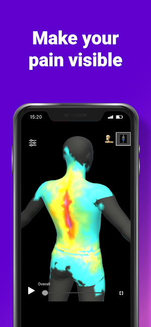 Chronic Insights: 3D symptom diary Screenshot 1