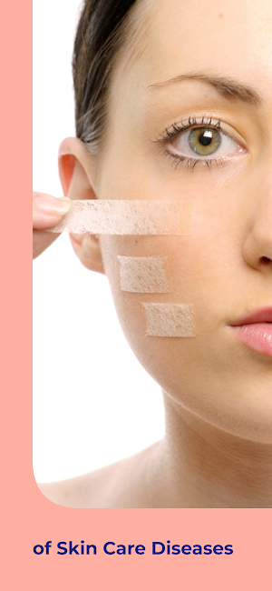 Skin Care Diseases & Treatment Screenshot 1