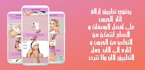 ازالة اثار الحبوب Screenshot 2