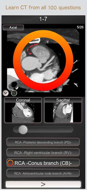 CT PassQuiz Heart / sectional anatomy / MRI Screenshot 0