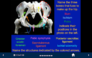 MSK Anatomy - SecondLook Screenshot 1