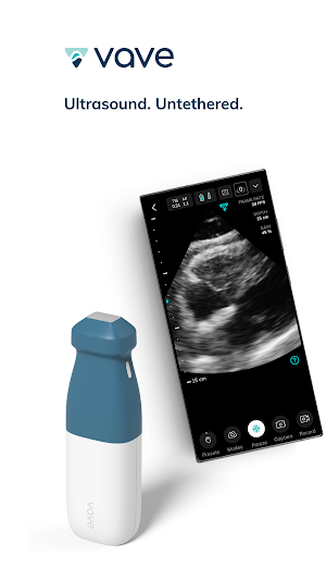 Vave Wireless Ultrasound Screenshot 0
