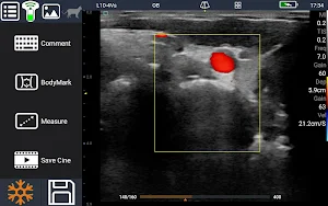 Youkey SonoiQVet - Pocket Ultr Screenshot 3