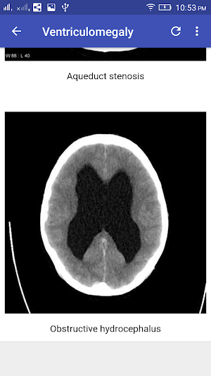 CT Brain Interpretation Screenshot 3