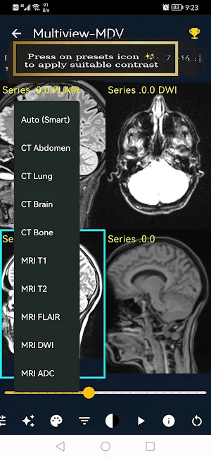 MDV - Medical Dicom Viewer Screenshot 3