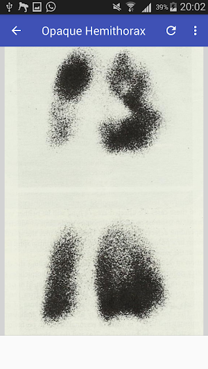 Clinical Chest Radiology Screenshot 1