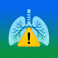 AllerAlert